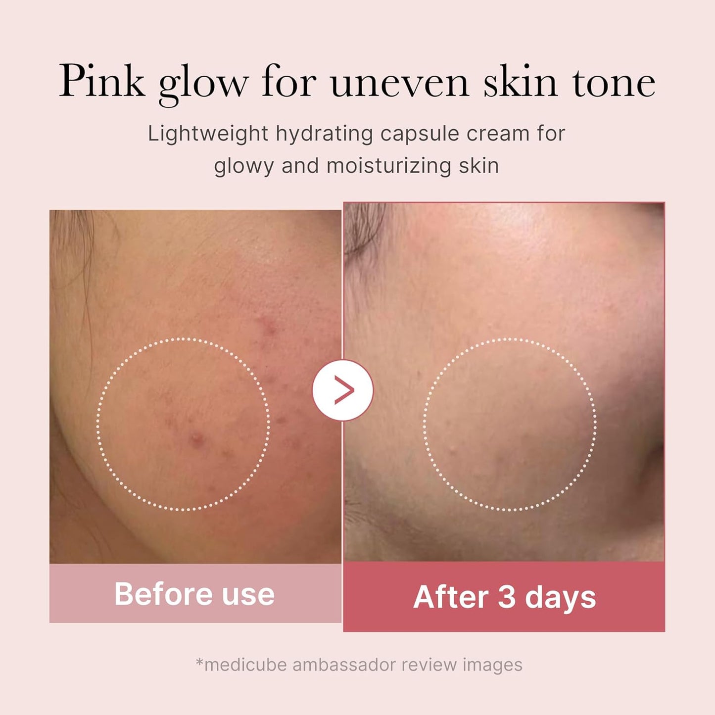 medicube Salmon DNA PDRN Pink Collagen Capsule Cream, Face Moisturizer | Lightweight Moisturizing Cream | PDRN, Niacinamide for Uneven Skin Tone, Glow hydration | Korean Skin Care 1.94 oz